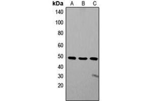 Western blot analysis of ZIC1/2/3 expression in SW480 (A), Jurkat (B), SHSY5Y (C) whole cell lysates.