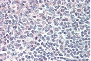 ABIN184813 (5µg/ml) staining of paraffin embedded Human Tonsil.