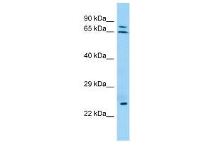WB Suggested Anti-KRT74 Antibody Titration: 1.