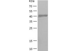 Western Blotting (WB) image for Calreticulin (CALR) (AA 18-417) protein (His tag) (ABIN7122110) (Calreticulin Protein (CALR) (AA 18-417) (His tag))