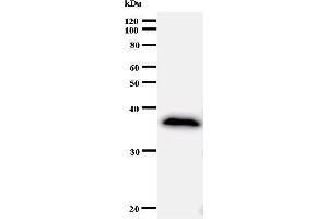 Western Blotting (WB) image for anti-Ankyrin Repeat Domain 11 (ANKRD11) antibody (ABIN933001)