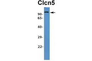Host:  Rabbit  Target Name:  Clcn5  Sample Type:  Rat Muscle  Antibody Dilution:  1.