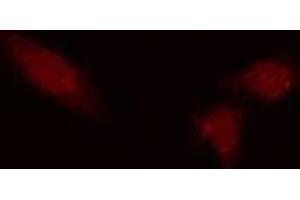 ABIN6275447 staining COLO205 cells by IF/ICC. (RAP1GAP anticorps  (Internal Region))
