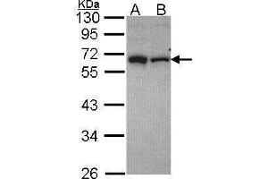 WB Image Sample (30 ug of whole cell lysate) A: Hep G2 , B: HCT116 10% SDS PAGE RAP1 antibody antibody diluted at 1:1000