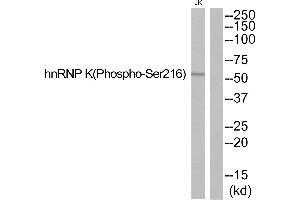 Western blot analysis of extracts from JurKat cells, using hnRNP K (Phospho-Ser216) antibody. (HNRNPK anticorps  (pSer216))