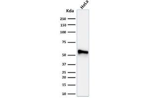 anti-Keratin 7 (KRT7) antibody