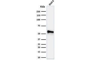 Western Blot Analysis of human HeLa cell lysate using Cytokeratin 7 Mouse Monoclonal Antibody (KRT7/760 + OV-TL12/30)