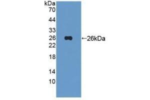 Detection of Recombinant Tie1, Human using Polyclonal Antibody to Tyrosine Kinase With Immunoglobulin Like And EGF Like Domains Protein 1 (Tie1)