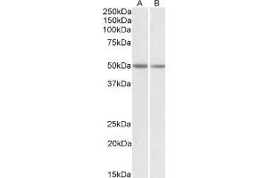 ABIN571171 (0. (GNAS anticorps  (Internal Region))