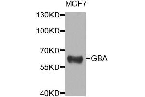 Western blot analysis of extracts of MCF-7 cells, using GBA antibody. (GBA anticorps  (AA 40-250))