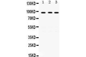 Western Blotting (WB) image for anti-K(lysine) Acetyltransferase 2A (KAT2A) (AA 75-106), (N-Term) antibody (ABIN3042472)