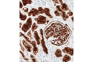 Immunohistochemical analysis of paraffin-embedded human kidney tissue using (ABIN6243087 and ABIN6577253) performed on the Leica® BOND RXm.