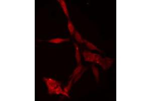ABIN6274750 staining Hela cells by IF/ICC. (RPS18 anticorps)