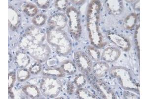 Detection of ICA1 in Human Kidney Tissue using Monoclonal Antibody to Islet Cell Autoantigen 1 (ICA1)