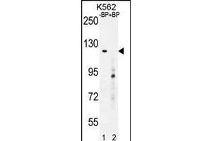 Western blot analysis of DEPD5 Antibody Pab pre-incubated without(lane 1) and with(lane 2) blocking peptide in K562 cell line lysate. (DEPDC5 anticorps  (C-Term))