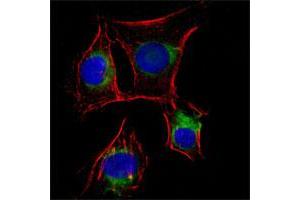 Immunofluorescence analysis of EC cells (rat aortic endothelial cells) using NGFR monoclonal antibody, clone 2F1C2  (green). (NGFR anticorps)