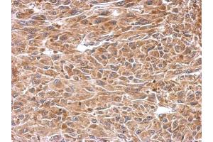 IHC-P Image Immunohistochemical analysis of paraffin-embedded U87 xenograft, using CESK1, antibody at 1:500 dilution.