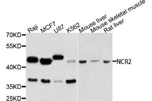 Western blot analysis of extracts of various cell lines, using NCR2 antibody (ABIN5995548) at 1/1000 dilution. (NKp44/NCR2 anticorps)