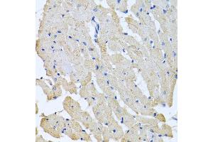 Immunohistochemistry of paraffin-embedded rat heart using GPLD1 antibody at dilution of 1:100 (40x lens). (GPLD1 anticorps)