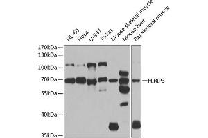 Western blot analysis of extracts of various cell lines, using HIRIP3 antibody (ABIN6128019, ABIN6141779, ABIN6141780 and ABIN6222788) at 1:1000 dilution. (HIRIP3 anticorps  (AA 417-556))