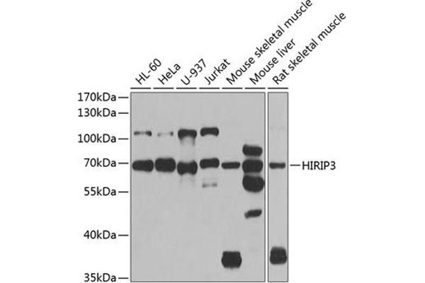 HIRIP3 Antikörper  (AA 417-556)