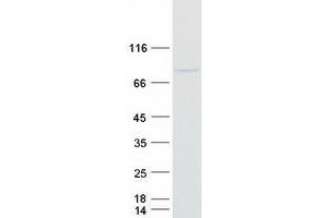 Validation with Western Blot