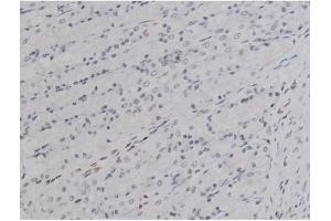 ABIN6256754 and ABIN6267331 at 1/200 staining Rat ganstric tissue sections by IHC-P.