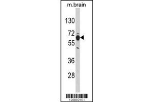 Western blot analysis of PHGDH Antibody in mouse brain tissue lysates (35ug/lane) (PHGDH anticorps  (N-Term))