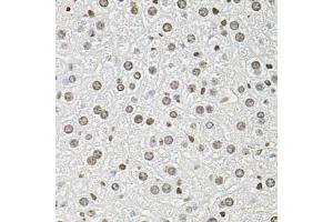 Immunohistochemistry of paraffin-embedded mouse liver using FOSL1 antibody. (FOSL1 anticorps)