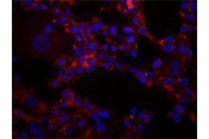 Immunofluorescence (IF) image for anti-Intercellular Adhesion Molecule 1 (ICAM1) antibody (ABIN2664765) (ICAM1 anticorps)