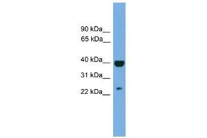 SOCS1 antibody used at 1 ug/ml to detect target protein. (SOCS1 anticorps  (Middle Region))