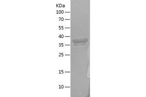 Western Blotting (WB) image for Cereblon (CRBN) (AA 1-80) protein (His-IF2DI Tag) (ABIN7122244)