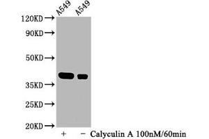 Western Blot Positive WB detected in A549 whole cell lysate(treated with Calyculin A or not) All lanes Phospho-NFKBIA antibody at 1.