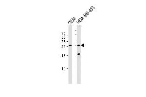 All lanes : Anti-IFI6 Antibody (N-term) at 1:1000 dilution Lane 1: CEM whole cell lysate Lane 2: MDA-MB-453 whole cell lysate Lysates/proteins at 20 μg per lane.