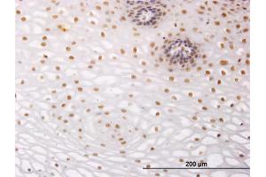 Immunoperoxidase of monoclonal antibody to NR2C2 on formalin-fixed paraffin-embedded human esophagus.