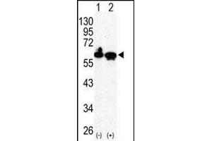 Western blot analysis of HDAC2 (arrow) using rabbit polyclonal HDAC2 Antibody (C-term) (ABIN6242378 and ABIN6577318). (HDAC2 anticorps  (C-Term))