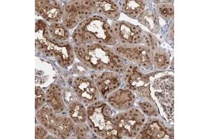 Immunohistochemical staining of human kidney with WDR44 polyclonal antibody  shows nuclear, cytoplasmic and membranous positivity in cells of tubules.