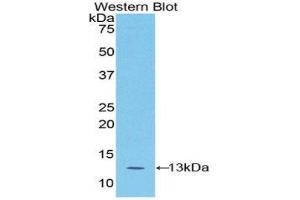 Western Blotting (WB) image for anti-S100 Calcium Binding Protein A4 (S100A4) (AA 1-101) antibody (ABIN1078504) (s100a4 anticorps  (AA 1-101))