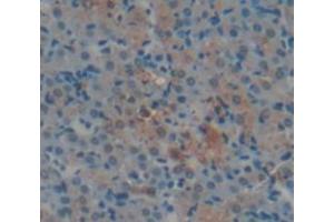 IHC-P analysis of Human Tissue, with DAB staining. (Aconitase 1 anticorps  (AA 669-834))