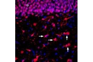 Expression of ENT2 in rat hippocampus - Immunohistochemical staining of perfusion-fixed frozen rat brain sections with Anti-ENT2 (SLC29A2) Antibody (ABIN7043711 and ABIN7044801), (1:300), followed by donkey anti-rabbit-biotin and streptatividin-Cy3.