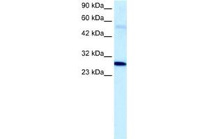 WB Suggested Anti-PAntibody Titration:  5. (PARP1 anticorps  (C-Term))