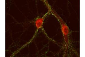 Indirect immunostaining of PFA fixed rat hippocampus neurons with anti-cytohesin 3 (dilution 1 : 500; red) and mouse anti-synapsin 1 (cat. (Cytohesin 3 anticorps)