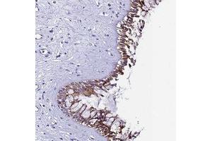 Immunohistochemical staining of human nasopharynx with UGT2A2 polyclonal antibody ( Cat # PAB28013 ) shows moderate cytoplasmic positivity in respiratory epithelial cells at 1:20 - 1:50 dilution. (UGT2A1 anticorps)