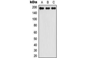 Western blot analysis of LMO7 expression in HEK293T (A), Raw264. (LMO7 anticorps  (Center))