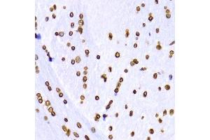 Immunohistochemistry of paraffin-embedded Rat brain using H3K9me3 antibody at dilution of 1:100 (x400 lens). (Histone 3 anticorps  (H3K9me3))