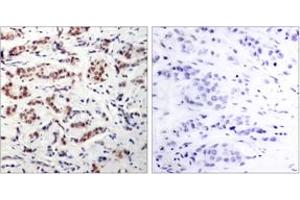 Immunohistochemistry (IHC) image for anti-STAT5 A/B (STAT5 A/B) (pTyr694) antibody (ABIN2888534) (STAT5 A/B anticorps  (pTyr694))