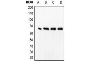Western blot analysis of SRF expression in Jurkat (A), MCF7 (B), HeLa (C), Raw264. (SRF anticorps  (Center))