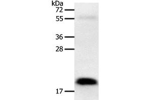 Western Blot analysis of Human colon cancer tissue using PTN Polyclonal Antibody at dilution of 1:600 (Pleiotrophin anticorps)