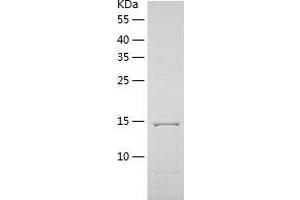 Western Blotting (WB) image for Thymic Stromal Lymphopoietin (TSLP) (AA 28-159) protein (His tag) (ABIN7125380) (Thymic Stromal Lymphopoietin Protein (TSLP) (AA 28-159) (His tag))