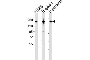 All lanes : Anti-MRC1L1 Antibody (N-term) at 1:2000 dilution Lane 1: human lung lysates Lane 2: human spleen lysates Lane 3: human placenta lysates Lysates/proteins at 20 μg per lane. (Macrophage Mannose Receptor 1 anticorps  (N-Term))